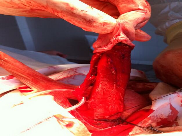 Трансвеститтері бар бисексуалдар Смотреть порно әйел любовник күйеуі жалап